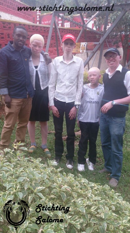 Klik hier voor de foto's van Albino kinderen
