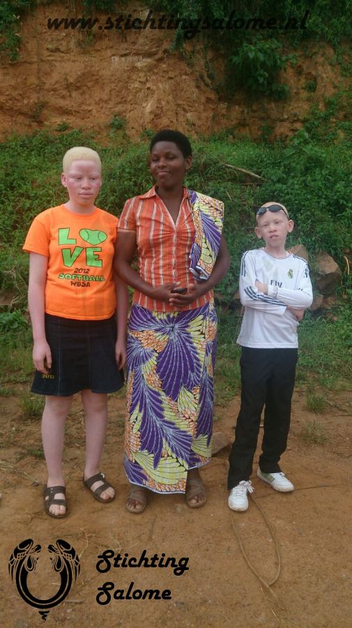 stichtingsalome-Albino kinderen 3.jpg