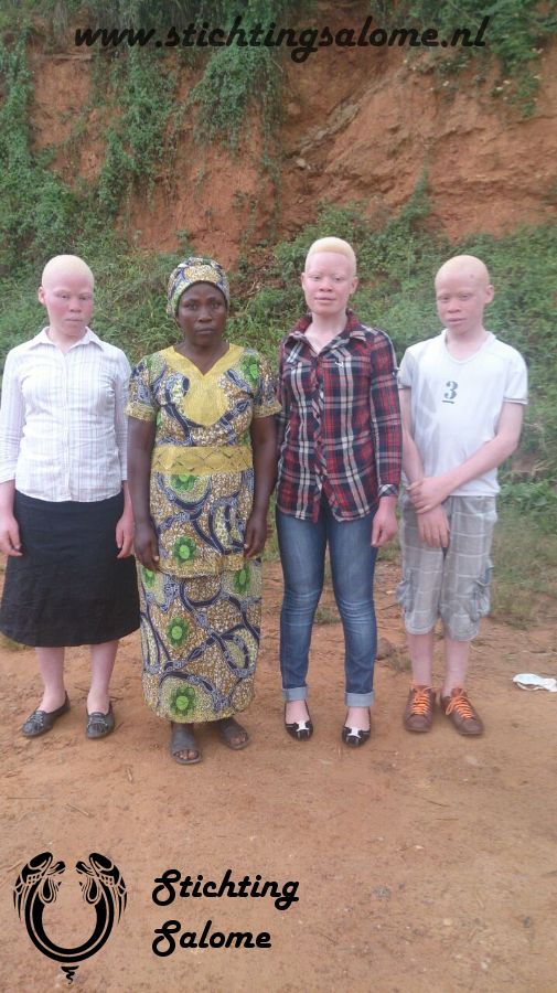 stichtingsalome-Albino kinderen 4.jpg