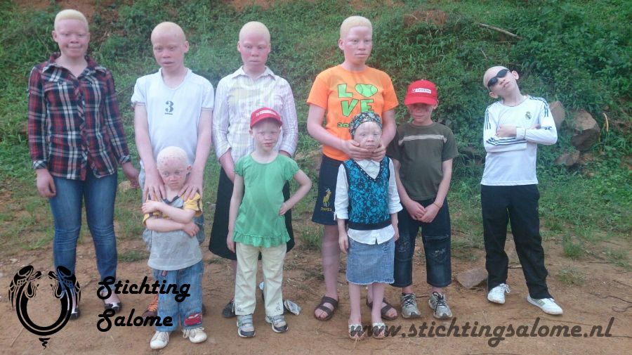 stichtingsalome-Albino kinderen 8.jpg